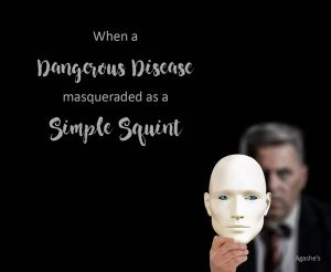 when a dangerous disease masqueraded as a simple squint