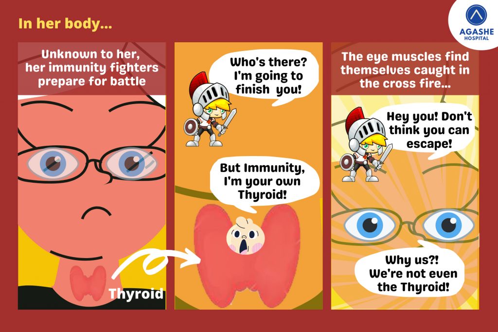 Thyroid Eye Disease symptoms