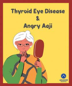 Thyroid eye disease and angry aaji