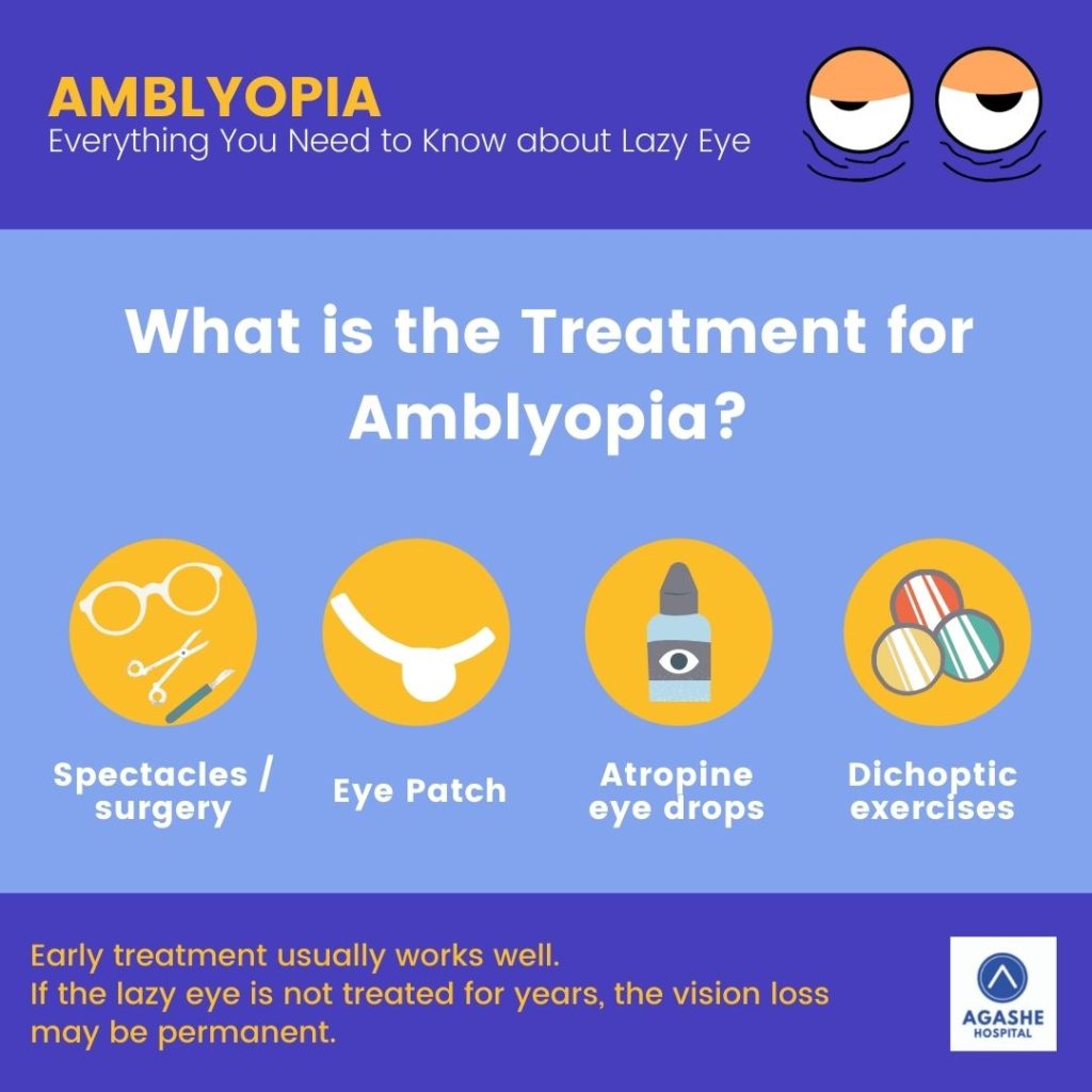 treatment for amblyopia